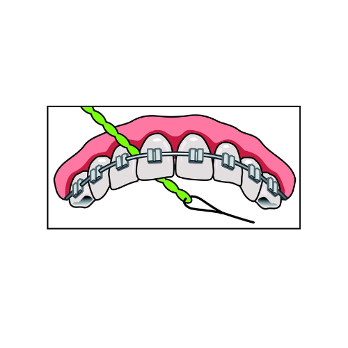 IDontix Brace X-Floss, Green - Image 3